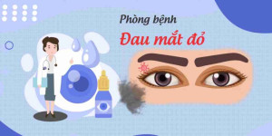 Bài tuyên truyền: Khuyến cáo phòng bệnh đau mắt đỏ